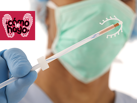 #MisTips Anticonceptivos de Larga Duración